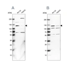 Anti-USP1 Antibody