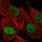 Immunofluorescent staining of human cell line U-251 MG shows localization to nucleoplasm.