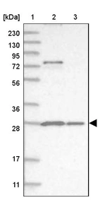 Lane 1: Marker [kDa] 230, 130, 95, 72, 56, 36, 28, 17, 11_br/_Lane 2: Human cell line RT-4_br/_Lane 3: Human cell line U-251MG sp