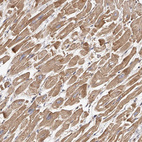 Immunohistochemical staining of human heart muscle shows strong cytoplasmic positivity in myocytes.