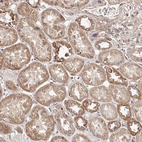 Immunohistochemical staining of human kidney shows strong cytoplasmic positivity in cells in tubules.