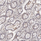 Immunohistochemical staining of human gastrointestinal shows moderate cytoplasmic positivity in glandular cells.