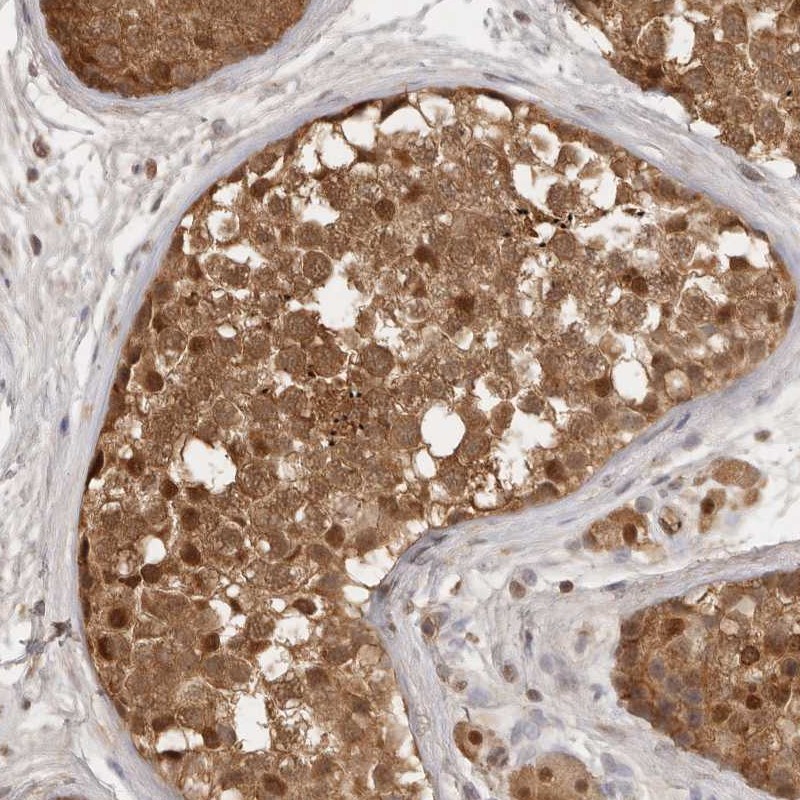 Anti-PSMA5 Antibody