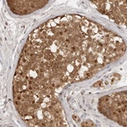 Anti-PSMA5 Antibody