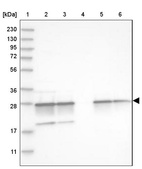Lane 1: Marker [kDa] 230, 130, 95, 72, 56, 36, 28, 17, 11_br/_Lane 2: Human cell line RT-4_br/_Lane 3: Human cell line U-251MG sp_br/_Lane 4: Human plasma (IgG/HSA depleted)_br/_Lane 5: Human liver tissue_br/_Lane 6: Human tonsil tissue