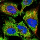 Immunofluorescent staining of human cell line U-251 MG shows localization to cytosol.