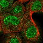 Immunofluorescent staining of human cell line A-431 shows localization to nucleoplasm, nuclear bodies & plasma membrane.