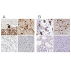 Immunohistochemical staining of human cerebellum, cerebral cortex, kidney and pancreas using Anti-CCSAP antibody HPA028402 (A) shows similar protein distribution across tissues to independent antibody HPA043443 (B).