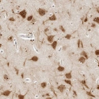 Immunohistochemical staining of human cerebral cortex shows high expression.