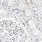 Immunohistochemical staining of human kidney using Anti-CCSAP antibody HPA028402.