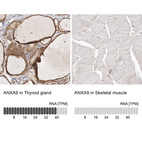 Anti-ANXA9 Antibody