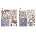 Anti-ANXA9 Antibody