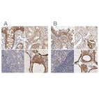Immunohistochemical staining of human colon, kidney, lymph node and thyroid gland using Anti-ANXA9 antibody HPA028404 (A) shows similar protein distribution across tissues to independent antibody HPA028698 (B).