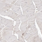 Immunohistochemical staining of human skeletal muscle shows low expression as expected.