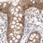 Immunohistochemical staining of human colon using Anti-ANXA9 antibody HPA028404.