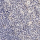 Anti-ANXA9 Antibody