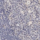 Immunohistochemical staining of human lymph node using Anti-ANXA9 antibody HPA028404.