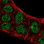 Anti-ATOH8 Antibody