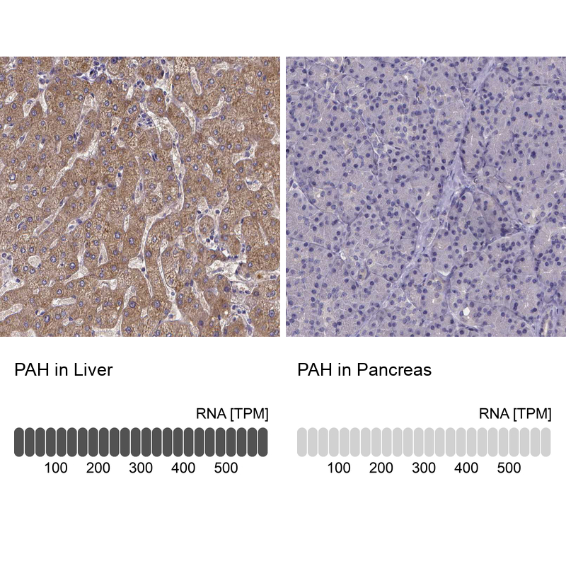 Anti-PAH Antibody