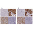 Immunohistochemical staining of human cerebral cortex, kidney, liver and pancreas using Anti-PAH antibody HPA028407 (A) shows similar protein distribution across tissues to independent antibody HPA031642 (B).