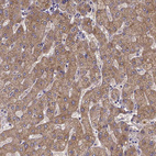 Immunohistochemical staining of human liver shows strong cytoplasmic positivity in hepatocytes.