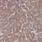 Immunohistochemical staining of human liver shows strong cytoplasmic positivity in hepatocytes.