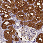 Immunohistochemical staining of human kidney shows strong cytoplasmic positivity in cells in proximal tubules.