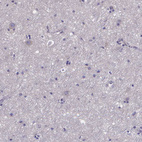 Immunohistochemical staining of human cerebral cortex shows no positivity in neurons as expected.
