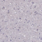 Immunohistochemical staining of human cerebral cortex shows no positivity in neurons as expected.