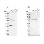Western blot analysis using Anti-PAH antibody HPA028407 (A) shows similar pattern to independent antibody HPA031642 (B).