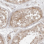 Anti-TRAPPC3 Antibody