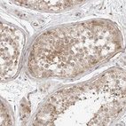 Anti-TRAPPC3 Antibody