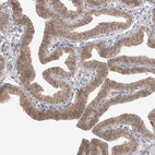 Immunohistochemical staining of human fallopian tube shows moderate cytoplasmic positivity in glandular cells.