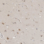 Immunohistochemical staining of human cerebral cortex shows moderate granular cytoplasmic positivity in neurons.