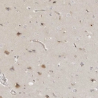 Immunohistochemical staining of human cerebral cortex shows moderate granular cytoplasmic positivity in neurons.
