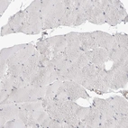 Immunohistochemical staining of human skeletal muscle shows no positivity in myocytes as expected.