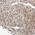 Anti-ABL1 Antibody