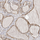 Immunohistochemical staining of human thyroid gland shows moderate cytoplasmic positivity in glandular cells.
