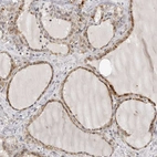 Immunohistochemical staining of human thyroid gland shows moderate cytoplasmic positivity in glandular cells.