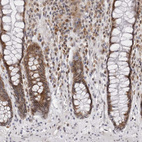 Immunohistochemical staining of human lower rectum shows moderate cytoplasmic and nuclear positivity in glandular cells.