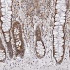 Immunohistochemical staining of human lower rectum shows moderate cytoplasmic and nuclear positivity in glandular cells.