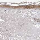 Immunohistochemical staining of human skin shows moderate cytoplasmic positivity in squamous epithelial cells.