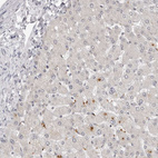 Immunohistochemical staining of human liver shows only very weak positivity in hepatocytes.