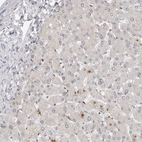 Immunohistochemical staining of human liver shows only very weak positivity in hepatocytes.