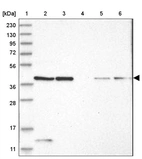 Lane 1: Marker [kDa] 230, 130, 95, 72, 56, 36, 28, 17, 11_br/_Lane 2: Human cell line RT-4_br/_Lane 3: Human cell line U-251MG sp_br/_Lane 4: Human plasma (IgG/HSA depleted)_br/_Lane 5: Human liver tissue_br/_Lane 6: Human tonsil tissue