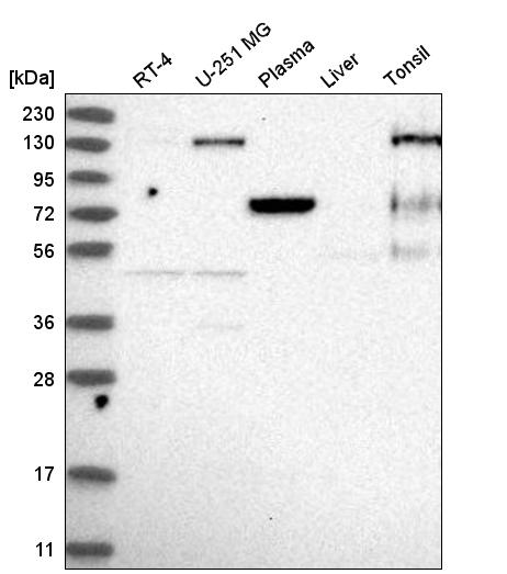 Anti-EPB41 Antibody