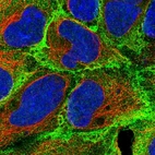 Immunofluorescent staining of human cell line HEK 293 shows localization to plasma membrane, cytosol & cell junctions.