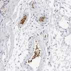 Anti-EPB41 Antibody