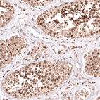 Anti-PHF20L1 Antibody