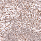 Immunohistochemical staining of human tonsil shows moderate nuclear positivity in non-germinal center cells.